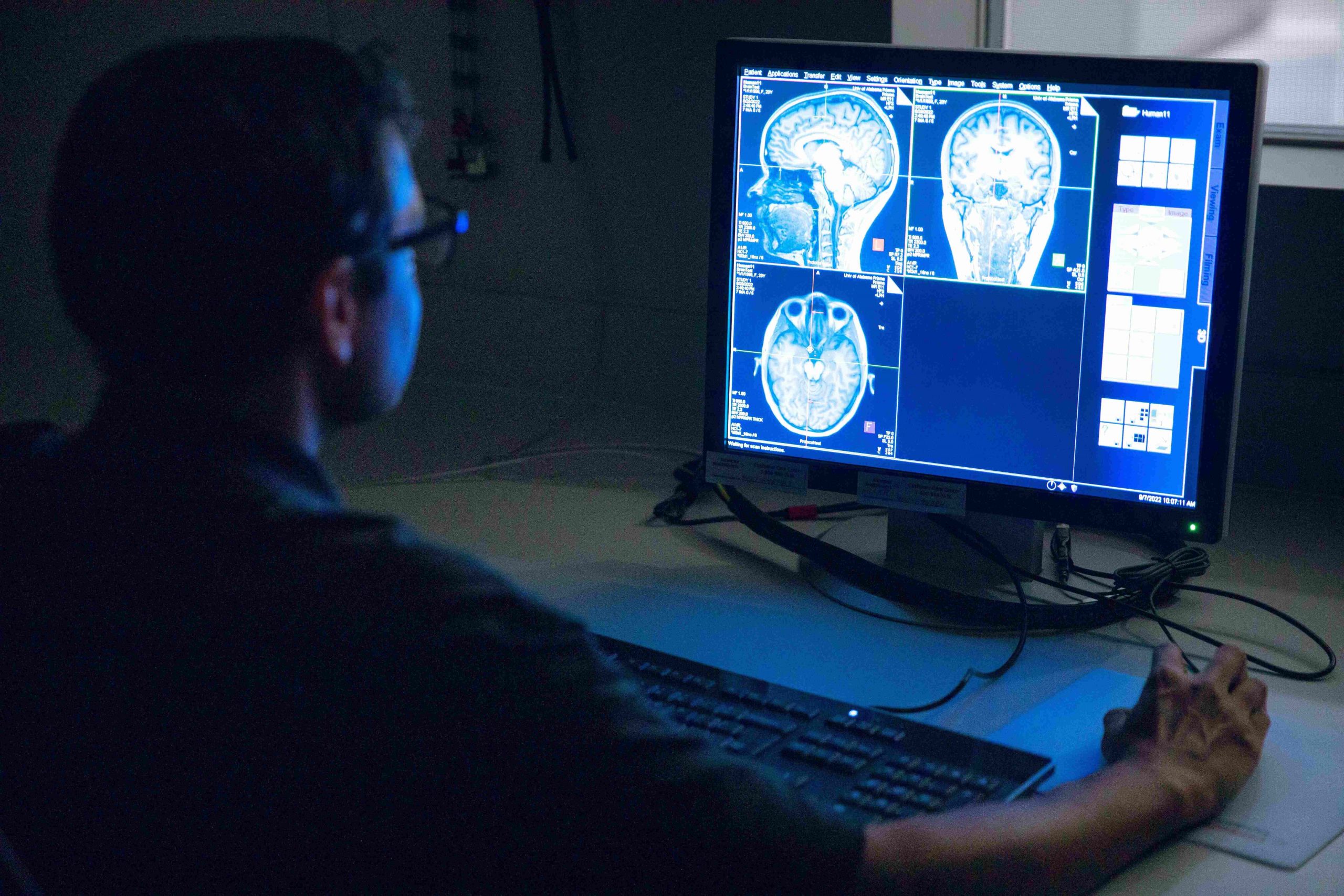 researcher examining MRI results